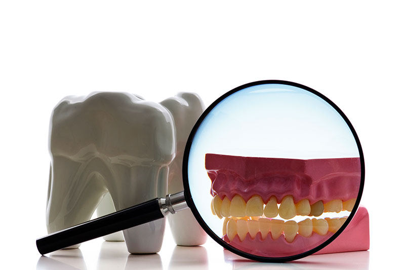 Root Canal Treatment in Lutherville-Timonium