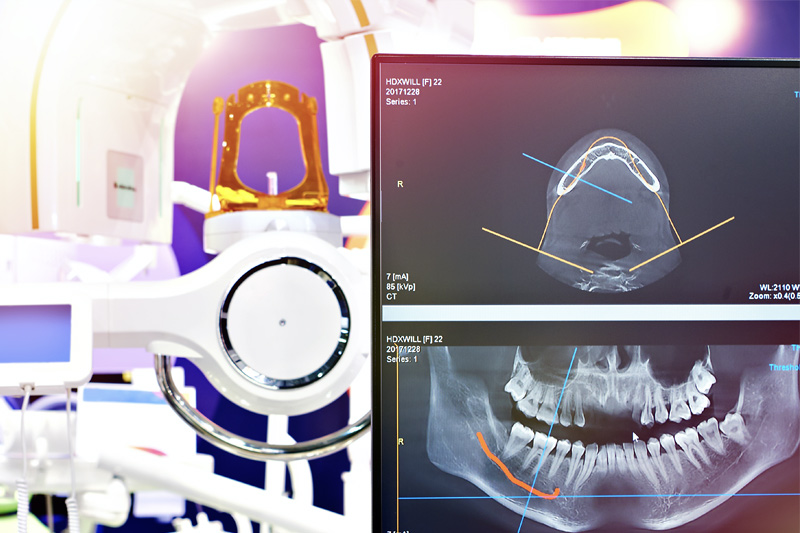 Digital X-Rays in Lutherville-Timonium